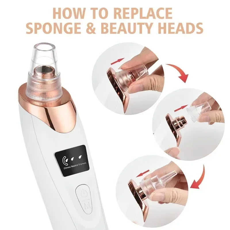 Glow-Up Pore Vacuum Kit